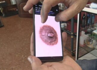 Tatuaxes ‘made in Sanxenxo’ para que as mulleres que tiveron cancro de mama recuperen a autoestima